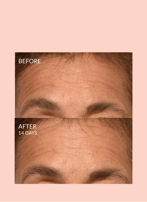 Triple Lift Molecule Mask